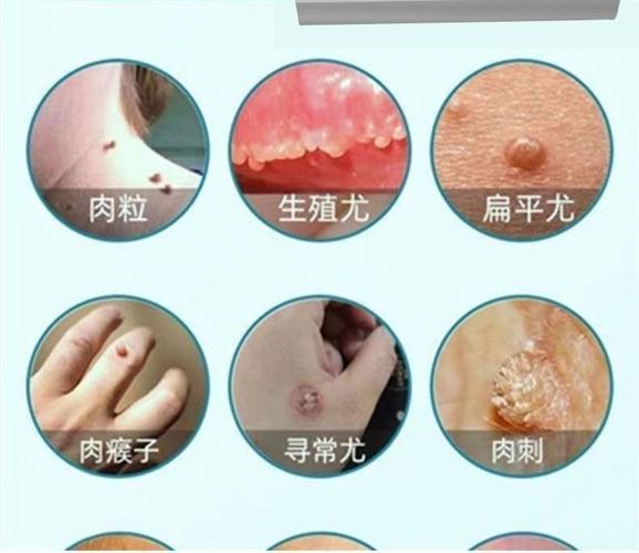 图文详情广州宸立生物制品生产厂家名称否是否为特殊用途化妆